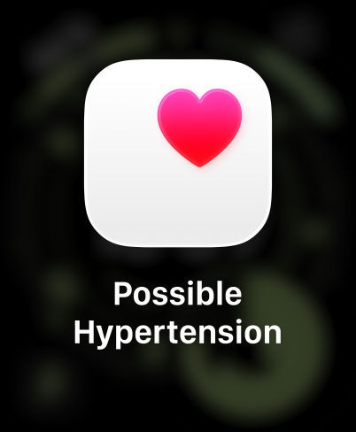 ساعة Apple Watch Ultra 3، إطار تيتانيوم، لون طبيعي، قلب وردي في صندوق أبيض، حزام Loop ترايل، لون أزرق/أزرق ساطع