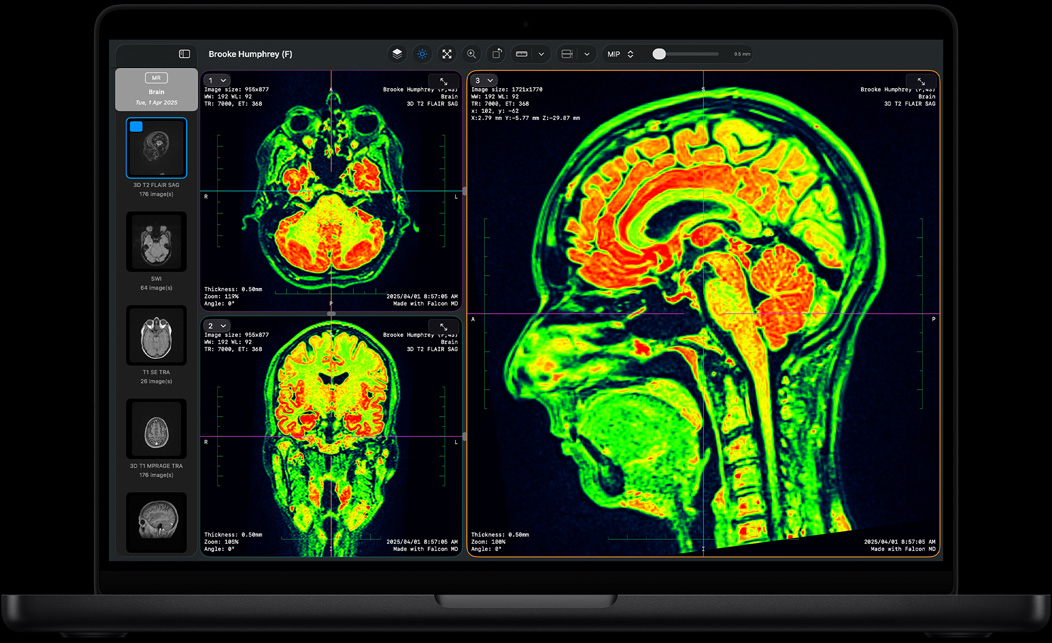 Pantalla de un MacBook Pro con la app Falcon MD