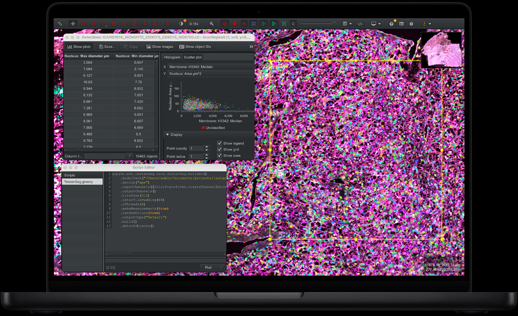 Screen of MacBook Pro showing QuPath and InstanSeg